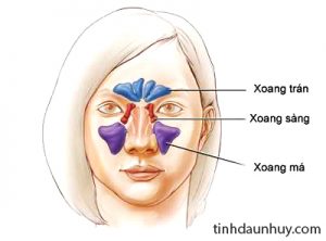 viemxoang